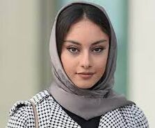 ترلان پروانه با ظاهری چندش آور | خانم ترلان پروانه چشه!