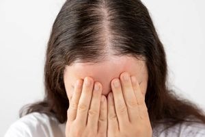 نازکی مو و ریزش آن!