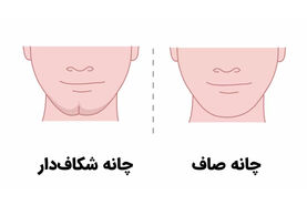 روانشناسی | شاید باورتان نشود که شکل چانه می‌تواند حقایق درونیتان را فاش کند!