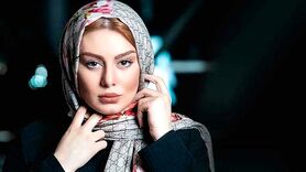 تغییر چهره عجیب سحر قریشی بعد از عمل | خانم سحر قریشی دیگه تو دبی به سیم آخر زده